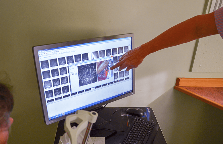 Optical Coherance Tomography (OCT)